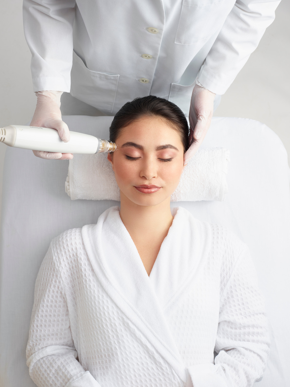 Microneedling treatment